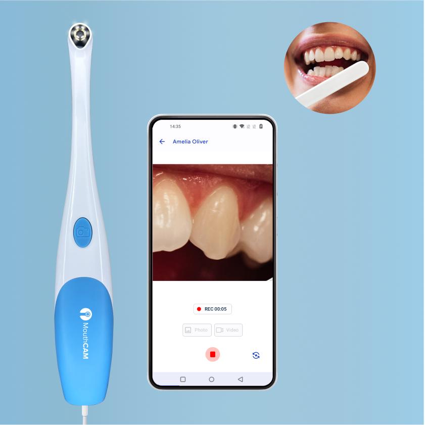 MouthCAM - Intraoral Camera
