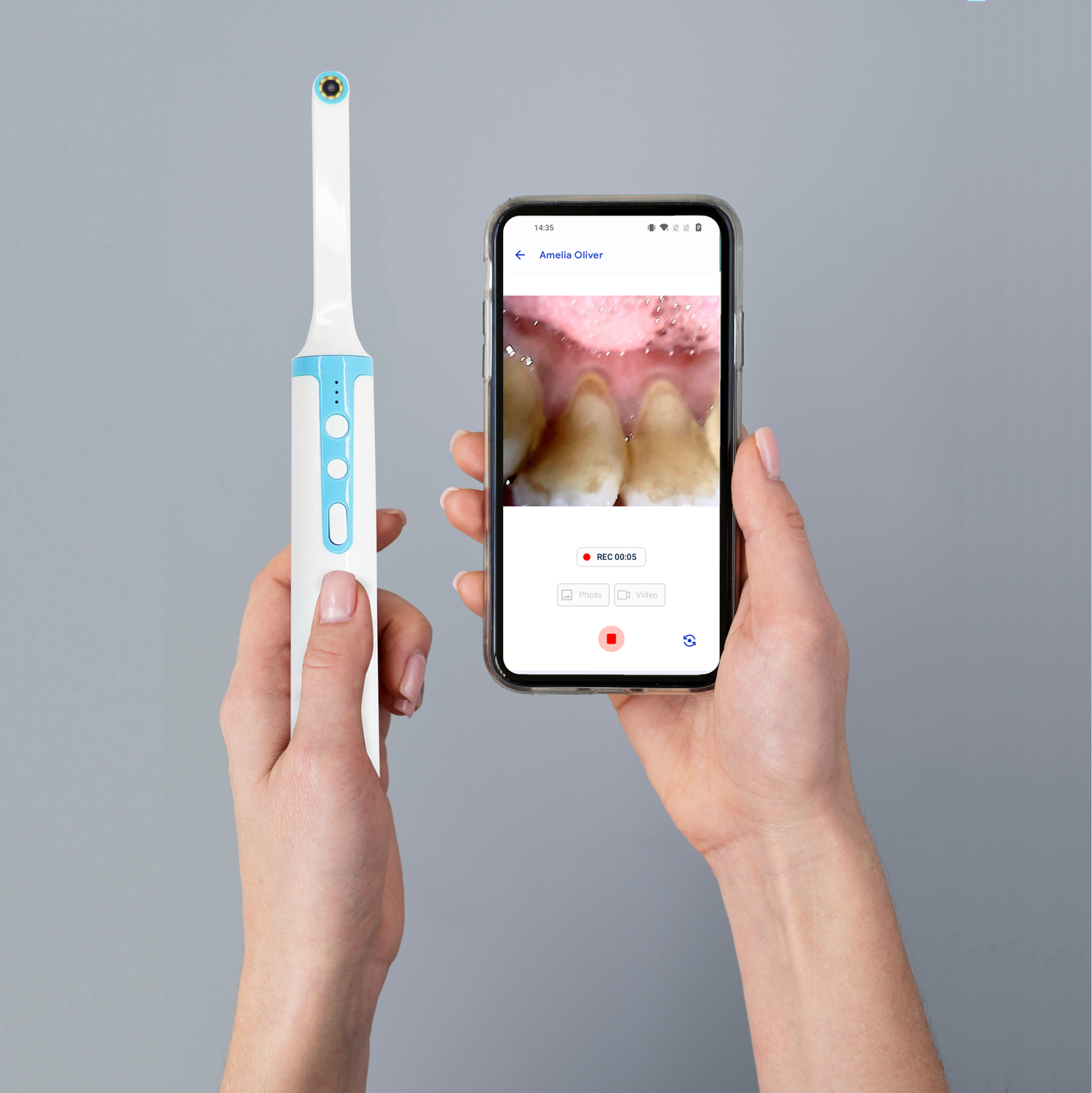Intraoral Camera