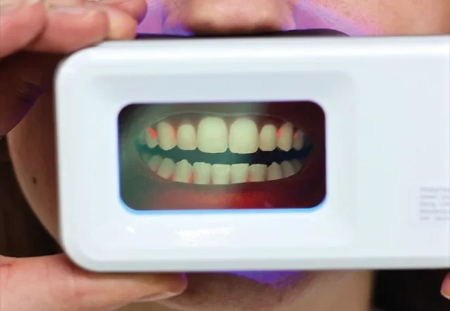 QScan Plus Biofilm Screening Device
