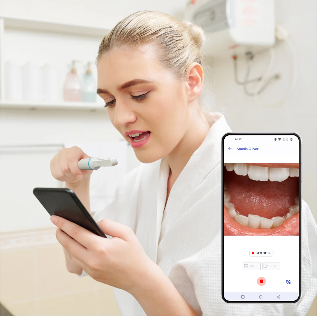 Wireless Personal Oral Health Tracking Camera - Includes Mirror and Retractors