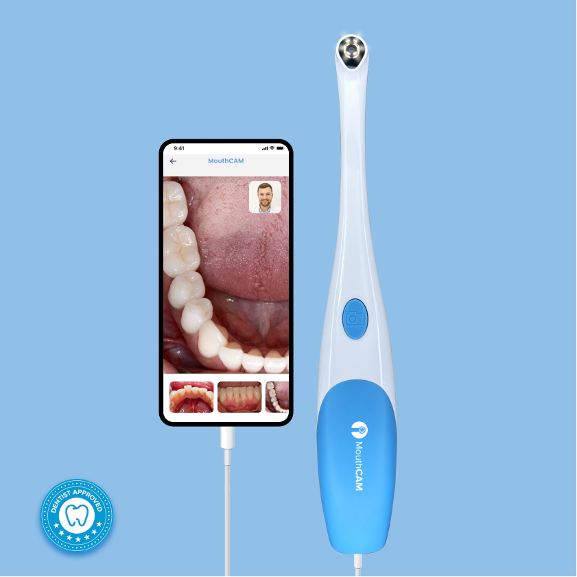 MouthCAM Wired Intraoral Camera